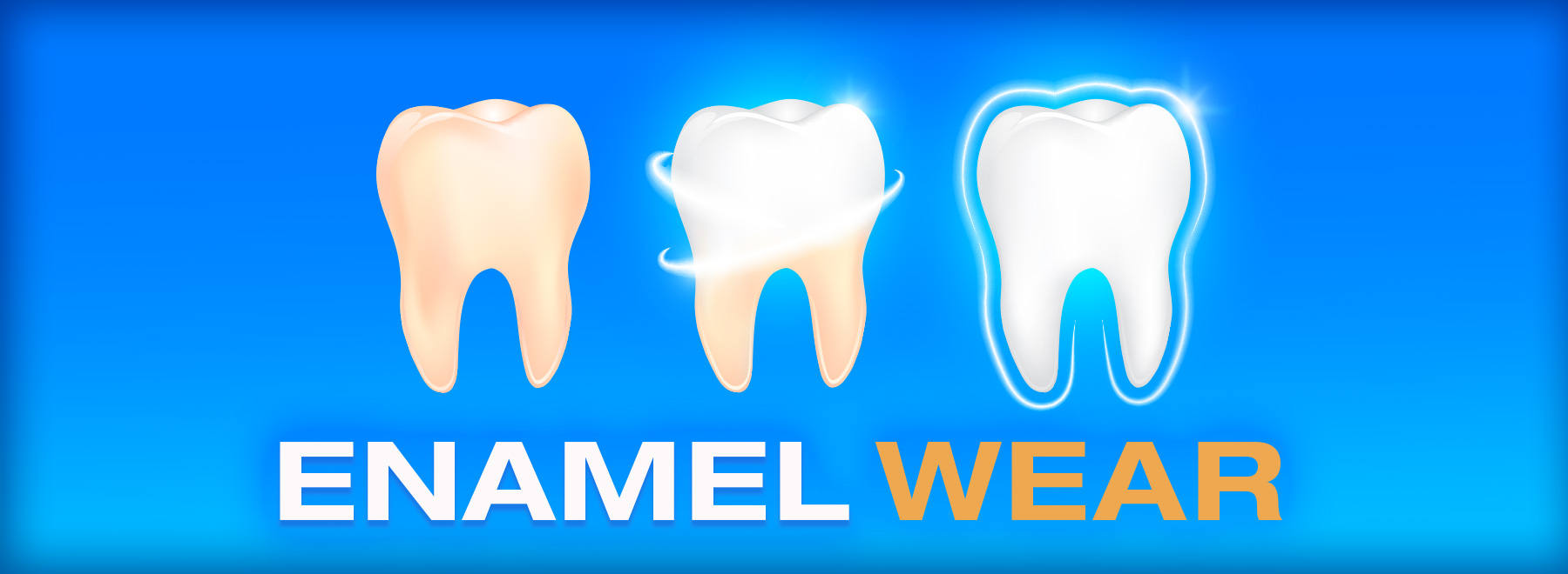 Illustration of tooth with bad enamel being restored to good enamel